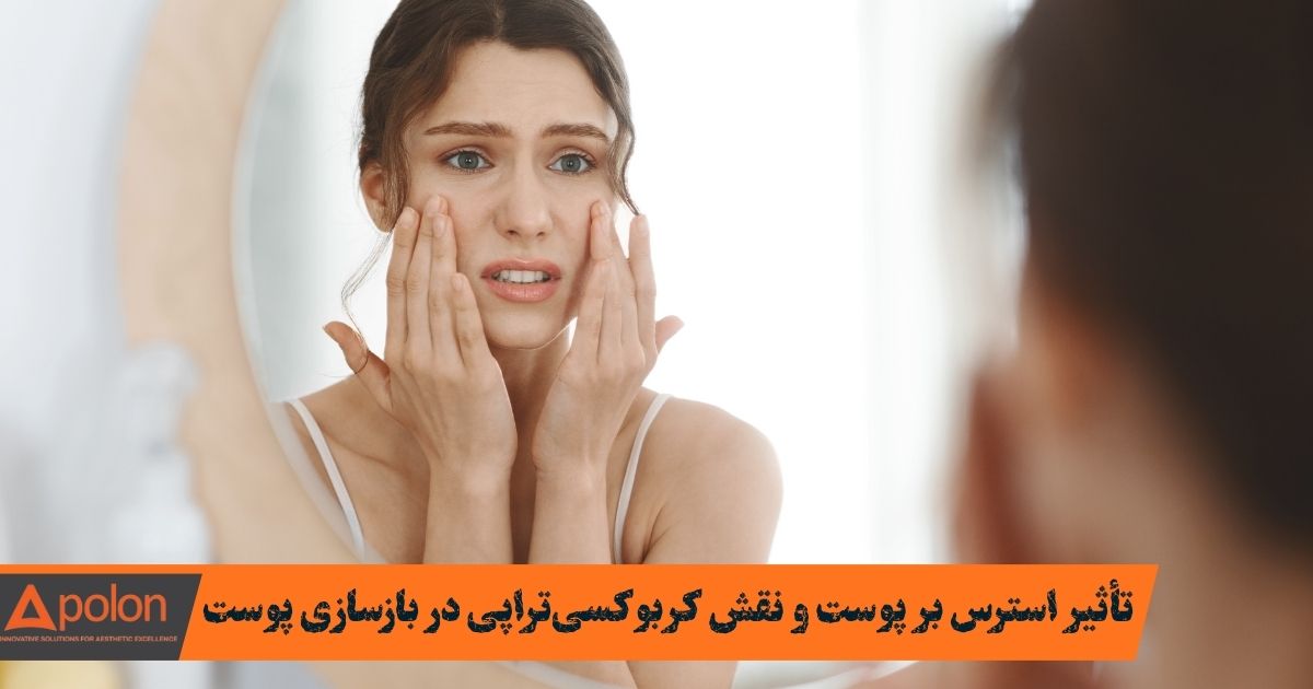 تأثیر استرس بر پوست و نقش کربوکسی‌تراپی در بازسازی پوست