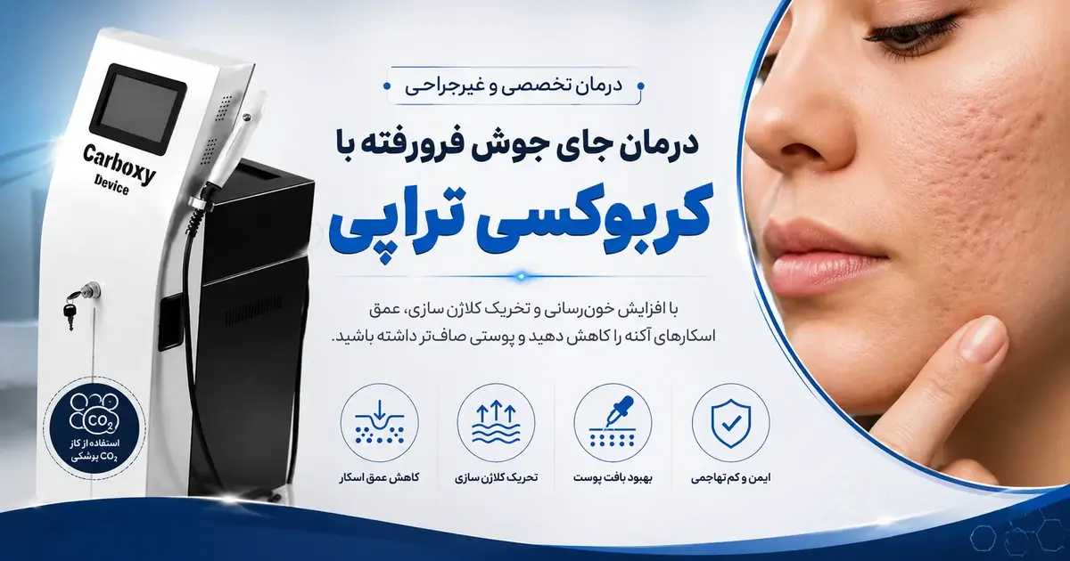 درمان جای جوش با کربوکسی تراپی