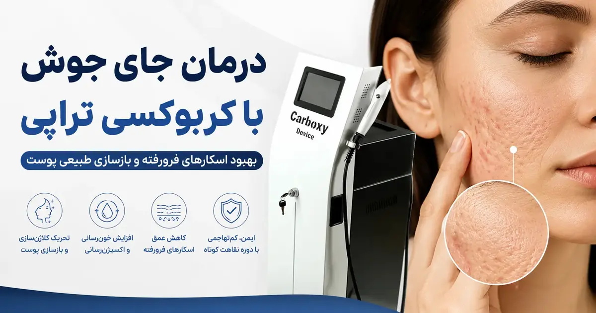 درمان جای جوش فرورفته با کربوکسی تراپی؛ هرآنچه باید بدانید