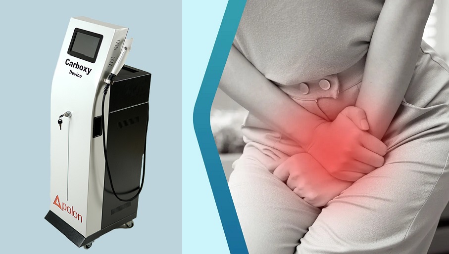 کربوکسی تراپی برای درمان بی اختیاری ادرار